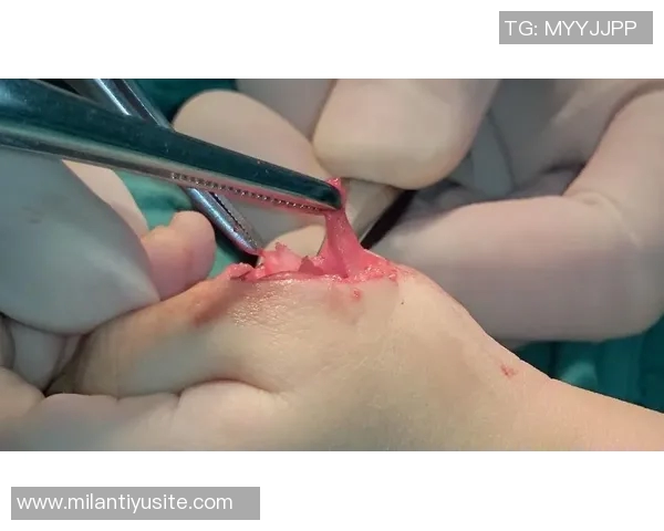 麦凯恩成功接受拇指韧带修复手术预计缺阵至少一个月